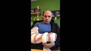 Week 1  Recovery Following Distal Bicep Tendon Tear Surgery [upl. by Adihaj]