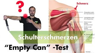 Schulterimpingement Testen  Supraspinatussehne Entzündet [upl. by Anigar]